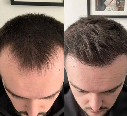 Rensola - Sérum Capilar Avanzado